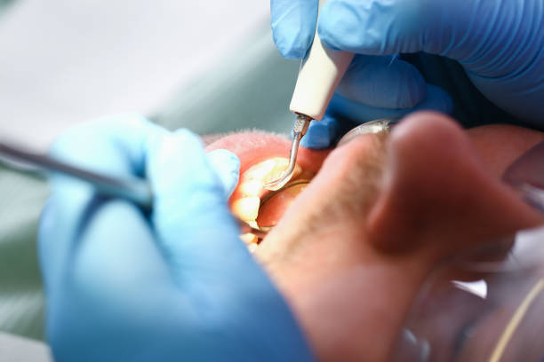 Best Weekend Emergency Dentist in Big Sandy, TX