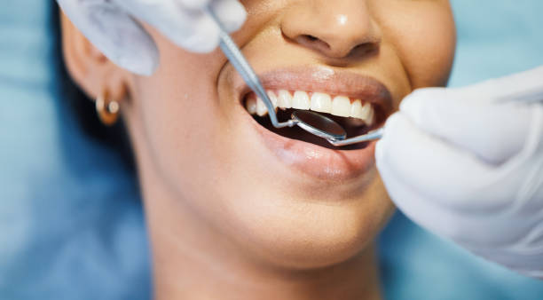 Best Emergency Dentist for Lost Fillings or Crowns in Big Sandy, TX